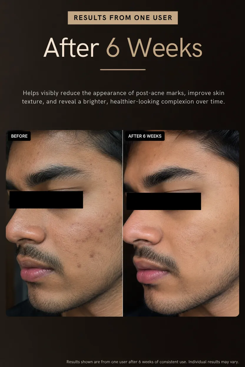 Cleanser thumbnail 2